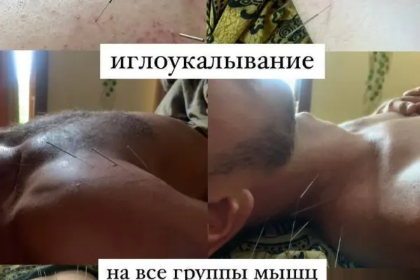 Лечебный и спортивный массаж 4