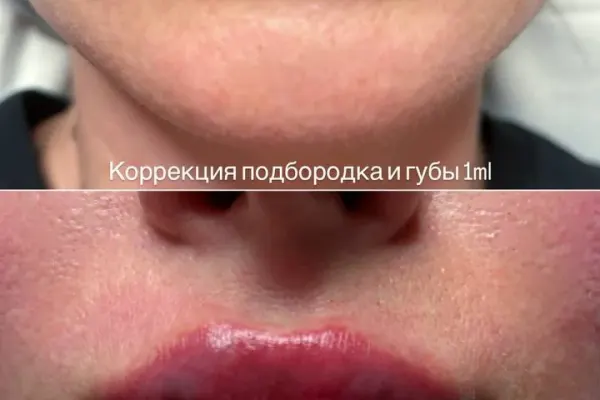 Косметолог-инъекционист 2