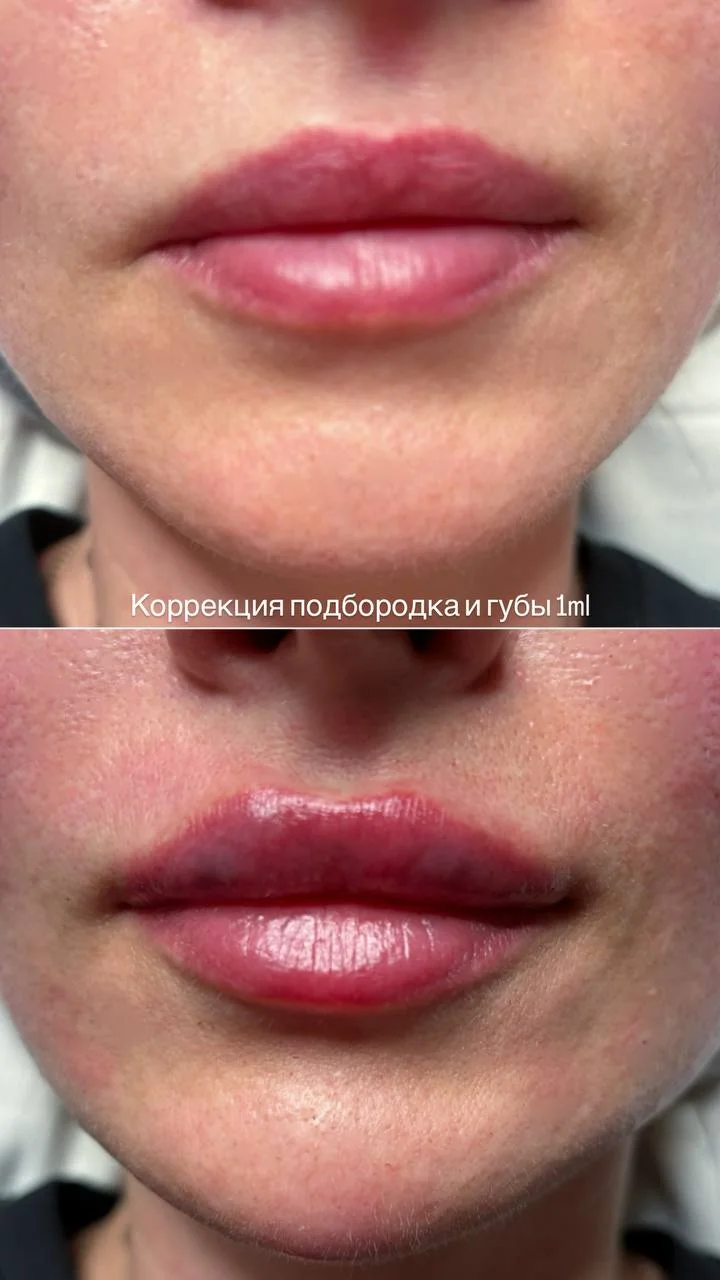 Косметолог-инъекционист 2